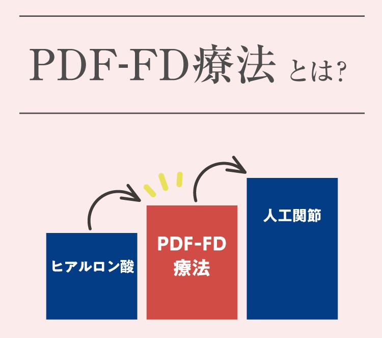 【画像】PDF-FD療法とは